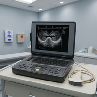 Système d'échographie vétérinaire numérique portable JINZHONG JZ-SW3000, imagerie haute résolution, design ergonomique
