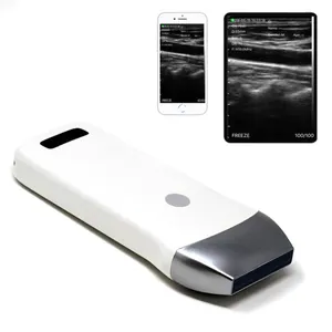 Kablosuz WiFi Mini el ultrason makinesi/ultrason tarayıcı probu B/M