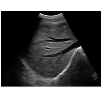 Système de diagnostic par ultrasons Doppler couleur 4D à prix compétitif 6 langues ultrasons portables