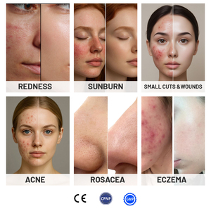Ácido hipocloroso Niebla facial Tratamiento para el acné Tónico en aerosol para pieles sensibles Eczema Rosacea Piercing suave Cuidado posterior y herida - Product Image 3