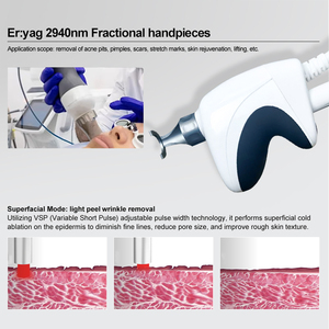 ระบบ <span class=keywords><strong>4D</strong></span> Pro พร้อมเลเซอร์เออร์เบียม 2940 นาโนเมตร เลเซอร์ CO2 แบบ Fractional แบบอยู่กับที่ สำหรับการกำจัดรอยแผลเป็น ยกกระชับใบหน้า ฟื้นฟูผิวให้ขาวกระจ่างใส - Product Image 3