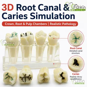 แบบจำลองการสอนการซีลรอยแตกในฟันแบบโปร่งใส 2X สำหรับสาธิตฟันผุพร้อมฟันที่ซีลและบูรณะแล้วเพื่อการศึกษาทางทันตกรรม - Product Image 3