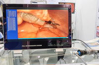 Système d'endoscopie médicale portable IKEDA 9122 4-en-1 Full HD 1080P électrique pour laparoscopie/cystoscopie/arthroscopie/diagnostic