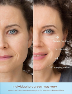 Tần số cao chăm sóc da mặt máy USB mắt thắt chặt loại bỏ nếp nhăn mặt nâng Massager cơ thể mụn trứng cá chăm sóc vẻ đẹp thiết bị - Product Image 3