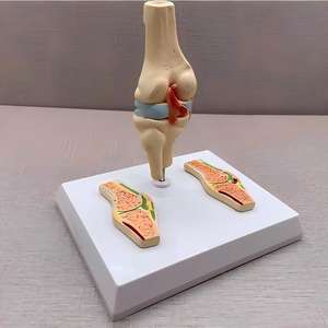 Modelo de Articulación de Rodilla con Artritis Reumatoide - Herramienta Educativa de <span class=keywords><strong>Ortopedia</strong></span> - Product Image 2