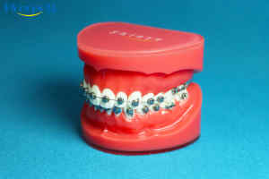 Shinye Orthodontische Dentale Ortodoncia Autoligatiebeugels Roth 022 Lasermark Self Ligating Orthodontie Beugels Tanden Beugels - Product Image 4