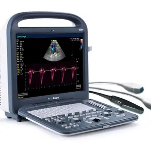 Portable 4D 5D ultrasound color doppler Sonoscape S2 colour Ultrasound