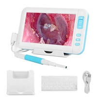 Endoscope otoscope portatif intelligent visuel de choix d'oreille de ménage de 3.9mm avec l'affichage d'écran, caméra d'endoscope d'oreille