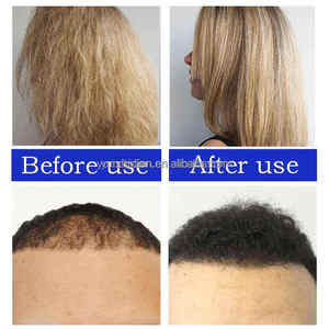 100% Raw Batana Oil Bulk for Hair Growth Batana Oil Pure <strong>Butter</strong> Hair Natual <strong>Butter</strong> 1 Litre 25kg 125kg Batana and Rosemary Oil - Product Image 5