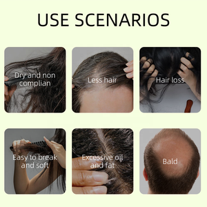 Shampoing Solide Platycladus Orientalis Marque Blanche Sans Sulfate Formule Anti-Chute et Croissance Capillaire Naturelle à Base <span class=keywords><strong>de</strong></span> Plantes Doux et Volumineux - Product Image 5