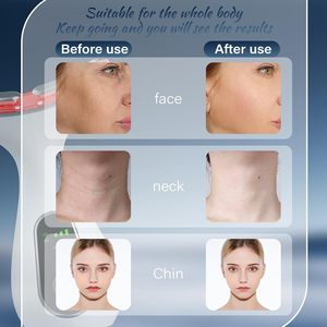 LED-Rotlichttherapie-Gesichts- und Nackenmassagegerät für zu Hause, 3 Modi, Reinigung, Heißliften, 6 Min. tägliche Anwendung, Faltenreduzierung, Hautstraffung, Kinnformung, Körperglanz - Product Image 6