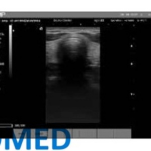Appareil à ultrasons portable économique pour l'imagerie médicale, scanner à ultrasons, appareil vétérinaire BW21B - Product Image 5