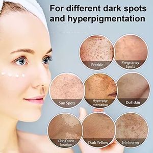 ETRUN ALISA Marque privée Crème à la niacinamide Correcteur des taches brunes pour les taches solaires Melasma Taches de rousseur Élimination des taches de vieillesse - Product Image 5