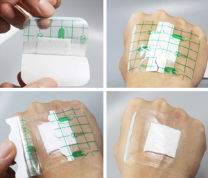 透明フィルムドレッシングパッド島デザインEO消毒クラスII医療機器CE/ISO13485認定カスタマイズサイズ傷 - Product Image 2
