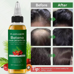 Set de Cuidado Capilar 5 en 1 de Marca Privada, Aceite Natural Prensado en Frío de Argán, Oliva, Árbol de Té, Aloe y Queratina para el Crecimiento del Cabello, Venta al Por Mayor OEM/ODM - Product Image 2