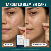 Patch anti-acné hydrocolloïde à micro-aiguilles dissolvant l'acide salicylique OEM, formule personnalisée, pour l'acné en phase précoce