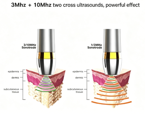 Portable Ultrasonic Facial Device <strong>3MHz</strong> 10MHz Skin Tightening Beauty Machine ODM Factory Anti Aging Lifting Skin Care Device - Product Image 5