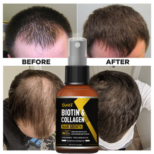 Logo personnalisé naturel organique anti-chute croissance rapide des cheveux sérum huile ensemble avec <span class=keywords><strong>Darma</strong></span> rouleau traitements de repousse Saw Palmetto - Product Image 5