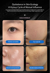 ทรีทเมนต์วงกลมดำสำหรับสปาอุปกรณ์ความงามสำหรับฟื้นฟูผิวให้กระชับความชุ่มชื้น - Product Image 3