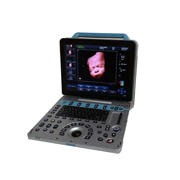 4D5D Fetusポータブルカラードプラー超音波スキャナー大画面OBレポート印刷