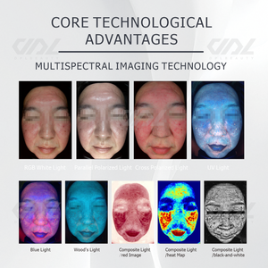 Analyseur de peau intelligent 3D portable à intelligence artificielle, scanner facial USB pour usage domestique, outil de diagnostic complet du visage - Product Image 4