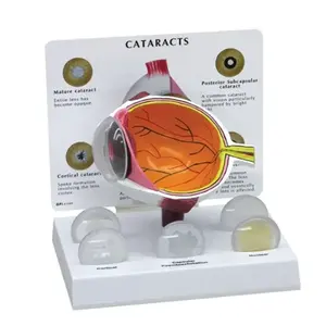 High品質ビッグサイズ人間Cataract眼モデル