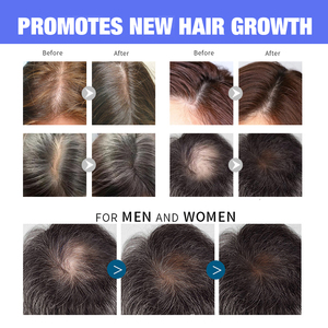 Ensemble de shampooing bouclé pour femmes noires, étiquette privée, biotine biologique, <span class=keywords><strong>Anti</strong></span>-<span class=keywords><strong>chute</strong></span>, croissance des <span class=keywords><strong>cheveux</strong></span>, shampoing et après-shampoing - Product Image 6