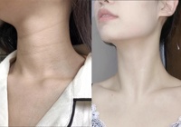 Vente en gros Masquage du cou éclaircissant et nourrissant Bio collagène Lifting et anti-âge Patchs anti-rides pour le cou