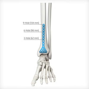 Implantes Ortopédicos de Titanio de Nuevo Diseño en Oferta, Placa para Radio Distal y Únula, Placa Ósea de Ángulo Variable, Implantes Ortopédicos Reutilizables - Product Image 3