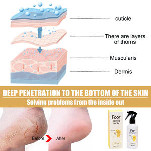 Nouvelle Tendance Marque Privée Enlever La Peau Morte Pieds Hydratant Hydratant Nourrir Peel Huile D'orange Spray Peeling Pour Les Pieds - Product Image 3