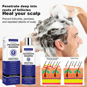 Shampoo pour cheveux 250 ml, soulage les démangeaisons, le cuir chevelu sec, les pellicules, l'<span class=keywords><strong>huile</strong></span> essentielle d'<span class=keywords><strong>arbre</strong></span> <span class=keywords><strong>à</strong></span> <span class=keywords><strong>thé</strong></span>, la dermatite séborrhéique, le <span class=keywords><strong>psoriasis</strong></span>, anti-folliculite - Product Image 2