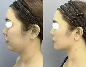 Siero Liquido Modellante per il Corpo 50ML |   Trattamento Rassodante e Tonificante per la Pelle - Product Image 3