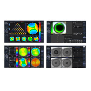 Equipo Oftalmológico Profesional MY-V056C, Máquina de Topografía Corneal Óptica para Cirugía Corneal - Product Image 4