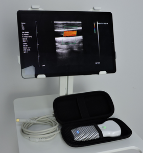Nuevos instrumentos analíticos clínicos de alta calidad, inalámbricos y Usb, matriz lineal, sonda de ultrasonido Doppler a Color, Konted C10UL - Product Image 6