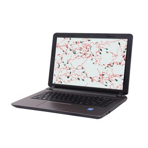 Analizador de <span class=keywords><strong>Semen</strong></span> Veterinario Portátil Automático, Sistema de Análisis de Calidad de Esperma Clínico - Product Image 2