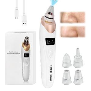 Limpiador Facial de Poros 0728, Eliminador de Puntos Negros y Espinillas con 5 Niveles de Succión - Product Image 2