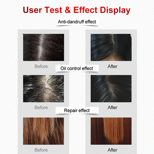 Großhandel Private Label Sulfatfreies Shampoo Natürliches Bio Haar Anti-Schuppen Feuchtigkeitsshampoo - Product Image 6