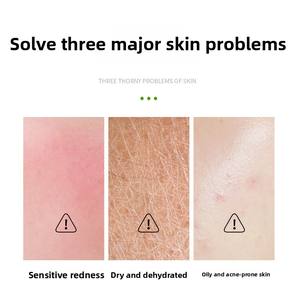 Set <span class=keywords><strong>de</strong></span> Viaje OEM/ODM: Loción Limpiadora Antienvejecimiento, Agua Hidratante con Hialuronato <span class=keywords><strong>de</strong></span> Sodio y Crema Facial Reafirmante para el Cuidado <span class=keywords><strong>de</strong></span> la Piel - Product Image 3