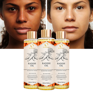 Vente en gros d'huile essentielle soins corporels blanchissante à la carotte huile essentielle carotène naturel pour enlever les cicatrices de taches foncées claires marque privée - Product Image 2
