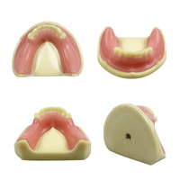 YOUYA DENTAL 1 pièce Modèle portable d'implant dentaire en résine pour la mâchoire inférieure 2009 pour les cliniques et les milieux éducatifs