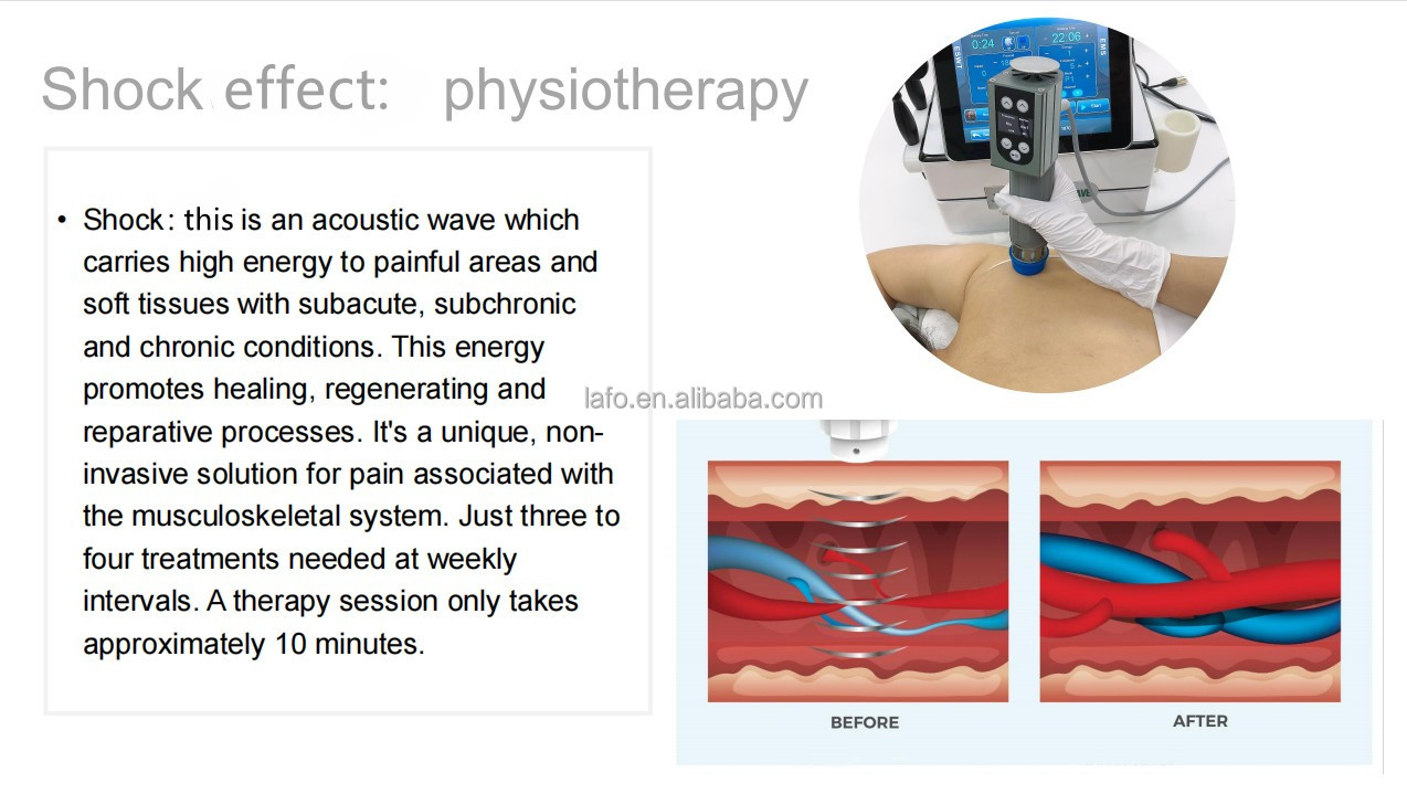 Factory phisiotherapy cet ret diathermy tecar body rehabilitation therapy/terapia tecar pain relief physio smart tecar m