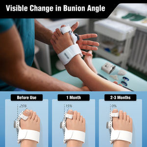 Tech Love Venta al por mayor Dispositivo de tracción y corrección Perilla ajustable Férula <span class=keywords><strong>para</strong></span> aliviar el dolor de pies <span class=keywords><strong>para</strong></span> la corrección suave de <span class=keywords><strong>juanetes</strong></span> - Product Image 6