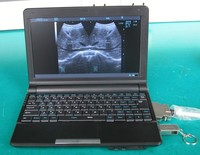 Mesin USG Laptop B Portabel Ringan dengan Baterai SUN-808S