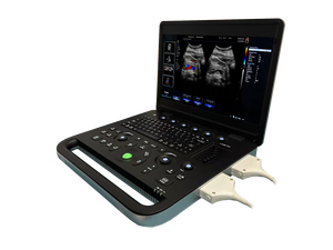 Échographe Doppler Couleur 2D 3D 4D 5D pour Hôpitaux et Cliniques, Appareil Portable de Fabrication d'Échographies - Product Image 3