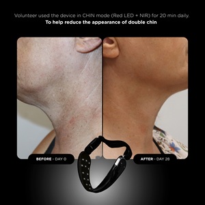 Masque pour le cou et le menton UNICLED 5.0 - Product Image 5