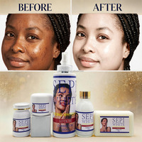 Ensemble de soins de la peau avancés SEPI White, éclaircit et unifie visiblement le teint, atténue les taches brunes et le mélasma pour les peaux foncées, vente en gros