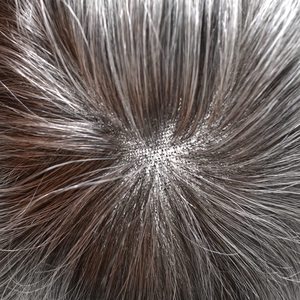 Tupé de Cabello Humano Natural Indio para Hombre, Base de Encaje Francés Completo, Sistema de Reemplazo para la Calvicie, Mezcla de Grises - Product Image 4