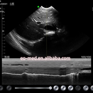 เครื่องสแกนอัลตราซาวนด์ไร้สายแบบพกพา ระบบอัลตราซาวนด์ Wi-Fi หัวตรวจไมโครคอนเว็กซ์ พร้อมระบบสีดอปเปลอร์ รุ่น CU15 มีจำหน่าย - Product Image 6