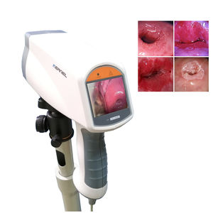 カーネルブランドKN-2200 LEDライトHDデジタルビデオコルポスコープ婦人科膣検査 - Product Image 2