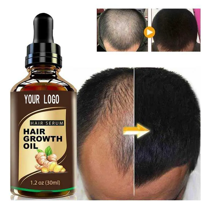 Best selling scalp hair growth product repair anti-hair loss men's organic hair growth oil treatment baldness Shampoo